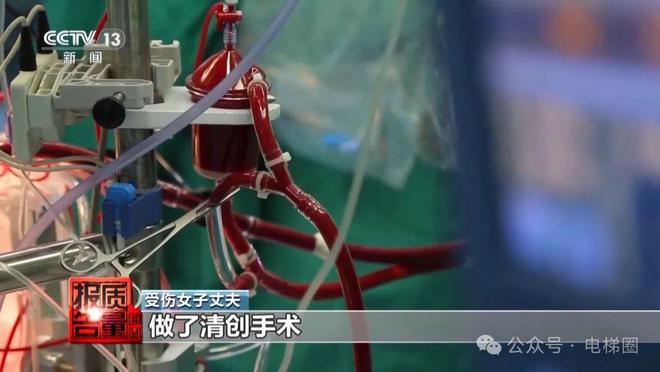 央视曝光电梯维保乱象：维保人员面临较大缺口报价远低成本价！(图2)