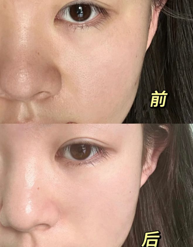 国产十大品牌面膜推荐揭晓：热门面膜排行榜前十名！(图4)